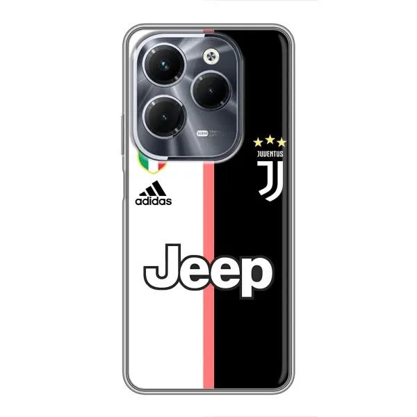 Чохол з принтом «Juventus» для Infinix Hot 40 Play