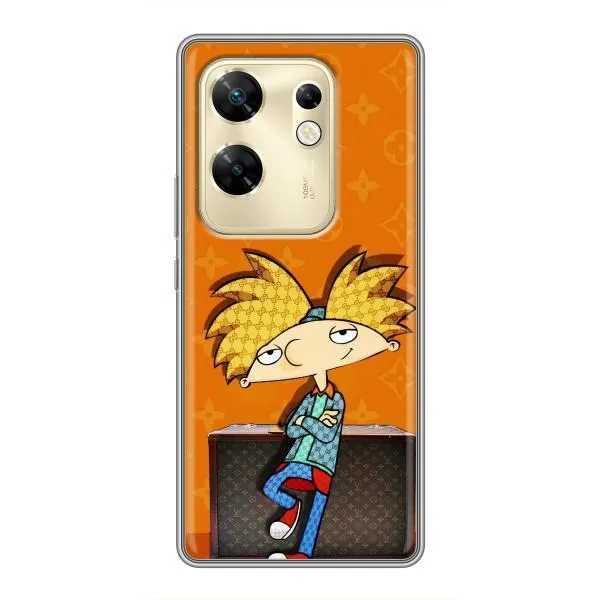 Чехол с принтом «Арнольд» для Infinix Zero 30