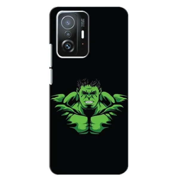 Чехол с принтом «Зелёный Халк» для Xiaomi 11T / 11T Pro Чехол с принтом «Зелёный Халк» для Xiaomi 11T / 11T Pro