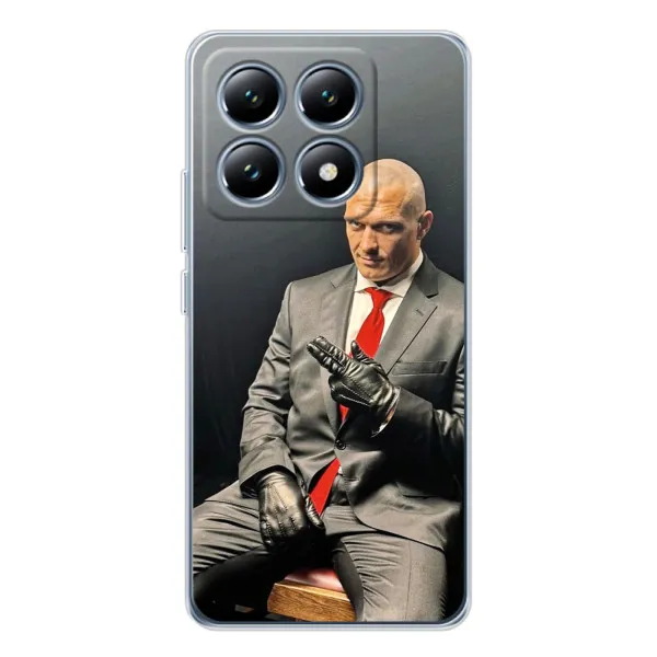 Чехол с принтом «Усик Hitman» для Xiaomi 15 Pro Чехол с принтом «Усик Hitman» для Xiaomi 15 Pro