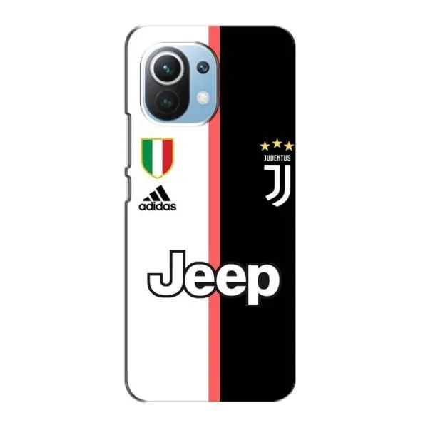 Чехол с принтом «Juventus» для Xiaomi Mi 11 Lite