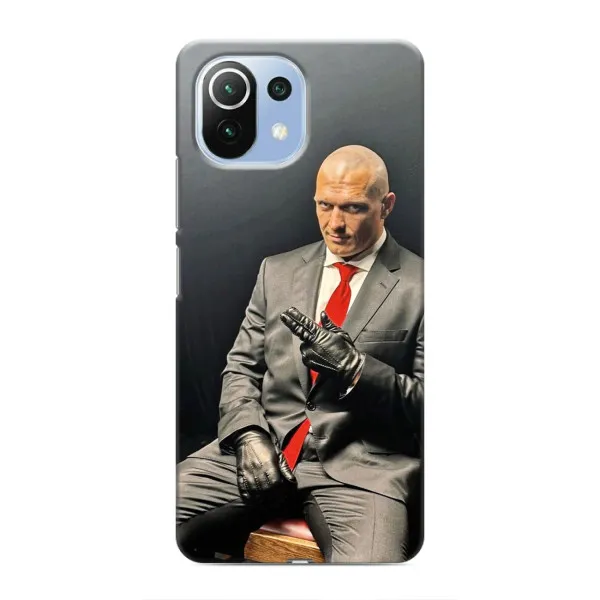 Чехол с принтом «Усик Hitman» для Xiaomi Mi 11 Lite Чехол с принтом «Усик Hitman» для Xiaomi Mi 11 Lite