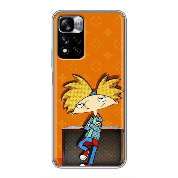 Чехол с принтом «Арнольд» для Xiaomi Redmi Note 11 Pro Plus