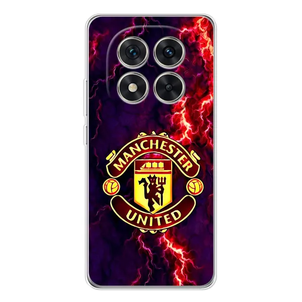 Чохол з принтом «вогняний Манчестер» для Xiaomi Redmi Note 15 Pro Plus Чохол з принтом «вогняний Манчестер» для Xiaomi Redmi Note 15 Pro Plus
