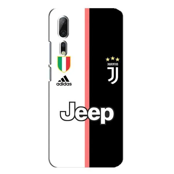 Чехол с принтом «Juventus» для ZTE Axon 10 Pro