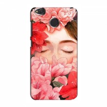 Чехлы (ART) Цветы на Xiaomi Redmi 4X (VPrint) Глаза в цветах - купить на Floy.com.ua