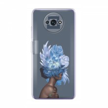 Чехлы (ART) Цветы на Xiaomi Redmi A3 (VPrint) Цветы на голове - купить на Floy.com.ua