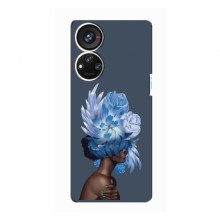 Чехлы (ART) Цветы на ZTE Blade V40s (VPrint) Цветы на голове - купить на Floy.com.ua