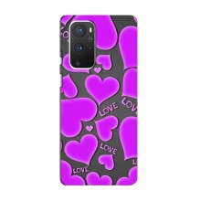 Чехлы для любимой на OnePlus 9 (VPrint) Pink hearts - купить на Floy.com.ua