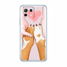 Чехлы с собаками для Xiaomi 11 Lite 5G (VPrint) Любовь к собакам - купить на Floy.com.ua