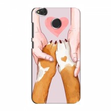 Чехлы с собаками для Xiaomi Redmi 4X (VPrint) Любовь к собакам - купить на Floy.com.ua
