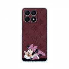 Чехол Disney Mouse Huawei Honor X8a (PREMIUMPrint) - купить на Floy.com.ua