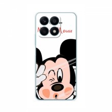 Чехол для Huawei Honor X8a (AlphaPrint) с печатью (ПРОЗРАЧНЫЙ ФОН) Mickey Mouse - купить на Floy.com.ua