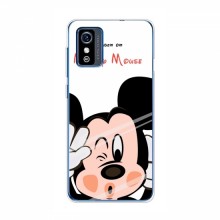 Чехол для ZTE Blade L9 (AlphaPrint) с печатью (ПРОЗРАЧНЫЙ ФОН) Mickey Mouse - купить на Floy.com.ua