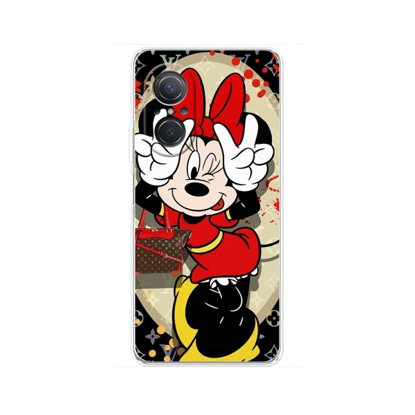 Чехол Disney Mouse Huawei Nova 9 SE (PREMIUMPrint)