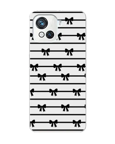 Чехол для Blackview Oscal C80 с картинкой «Полосатый ритм» Чехол для Blackview Oscal C80 с картинкой «Полосатый ритм»