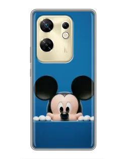 Чохол для Infinix Zero 30 з картинкою «Міккі виглядає»