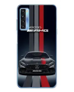 Чохол для TCL 20L Plus з картинкою «Mercedes — білий карбон» Чохол для TCL 20L Plus з картинкою «Mercedes — білий карбон»