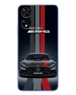 Чохол для TCL 505 з картинкою «Mercedes — білий карбон»