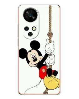 Чехол для Ulefone Note 17 Pro с картинкой «Mickey на канате» Чехол для Ulefone Note 17 Pro с картинкой «Mickey на канате»