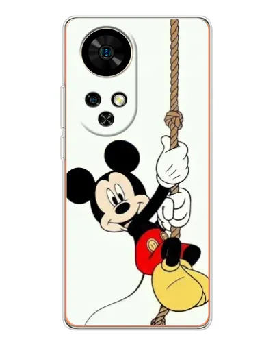 Чехол для Ulefone Note 17 Pro с картинкой «Mickey на канате» Чехол для Ulefone Note 17 Pro с картинкой «Mickey на канате»
