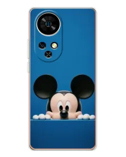 Чехол для Ulefone Note 17 Pro с картинкой «Микки выглядывает»