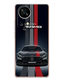 Чохол для Ulefone Note 17 Pro з картинкою «Mercedes — білий карбон» Чохол для Ulefone Note 17 Pro з картинкою «Mercedes — білий карбон»