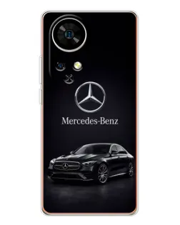 Чохол для Ulefone Note 17 Pro з картинкою «Mercedes — решітка радіатора»