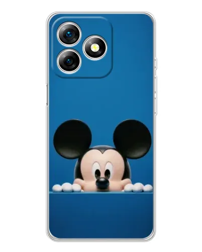 Чохол для Ulefone Note 18 Pro з картинкою «Міккі виглядає» Чохол для Ulefone Note 18 Pro з картинкою «Міккі виглядає»