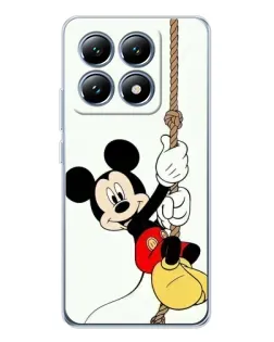 Чохол для Xiaomi 14T з картинкою «Mickey на канаті»