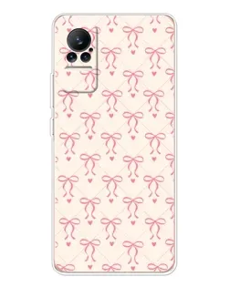 Чохол для Xiaomi Civi з картинкою «Рожеві бантики Coquette»