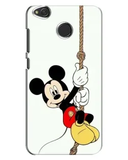 Чохол для Xiaomi Redmi 4X з картинкою «Mickey на канаті»