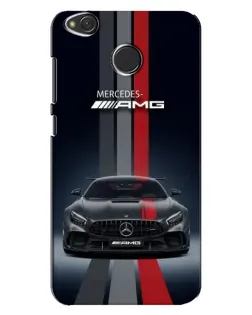 Чохол для Xiaomi Redmi 4X з картинкою «Mercedes — білий карбон»