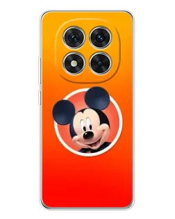 Чохол для Xiaomi Redmi Note 15 Pro 5G з картинкою «Mickey в колі»