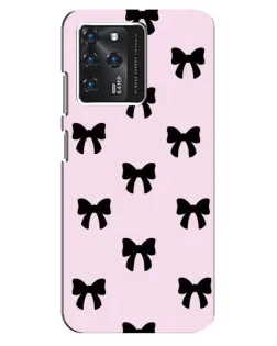 Чохол для ZTE Blade V30 з картинкою «Чорні банти Coquette»