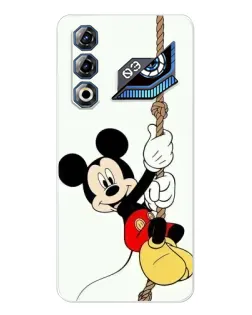 Чехол для ZTE Nubia Neo 3 GT с картинкой «Mickey на канате» Чехол для ZTE Nubia Neo 3 GT с картинкой «Mickey на канате»