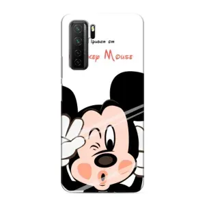 Эксклюзивный чехол для Honor 30s (AlphaPrint - Мультяшные) (Маус Микки)