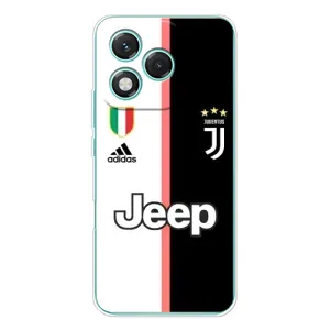 Чохли для Huawei Honor 400 Lite (VPrint) - Футбольні клуби (Juventus)