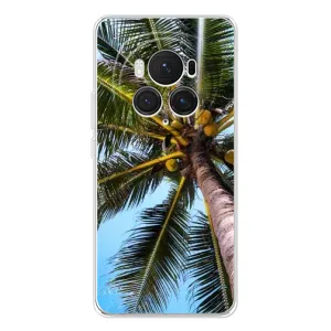 Силіконовий чохол з КАРТИНКАМИ літо для Huawei Honor Magic 7 Pro (AlphaPrint) (Пальма)