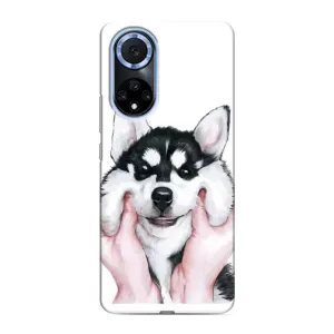 Чохол з Хаскі Huawei Honor X7b - (AlphaPrint) (Хаскі улибака)