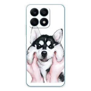 Чехол с Хаски для Huawei Honor X8a - (AlphaPrint) (Хаски улыбака)