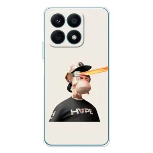 Чехлы с Обезьянами NFT для Huawei Honor X8a (AlphaPrint) (обезьяна NFT в очках)