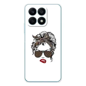 Чехлы Луи Витон для Huawei Honor X8a (AlphaPrint - LOUIS VUITTON) (стильная с луи витон)
