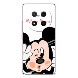 Эксклюзивный чехол для Huawei Honor X9c (AlphaPrint - Мультяшные) (Маус Микки)
