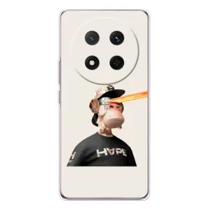 Чехлы с Обезьянами NFT для Huawei Honor X9c (AlphaPrint) (обезьяна NFT в очках)