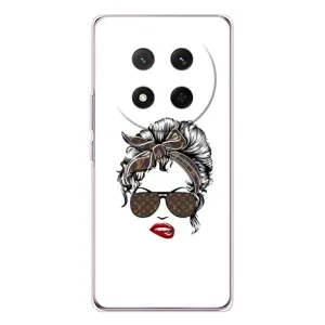 Чохли Луі Вітон для Huawei Honor X9c (AlphaPrint - LOUIS VUITTON) (стильна з луі вітон)