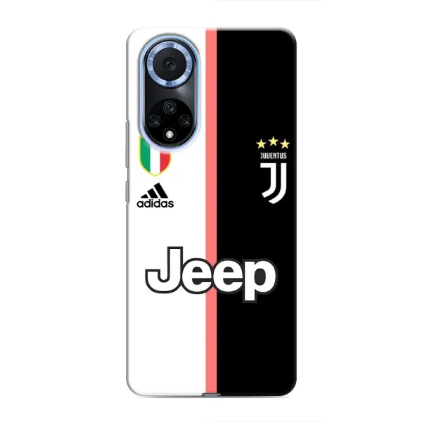 Чохол з принтом «Juventus» для Huawei Nova 9 SE