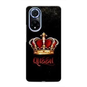 Чохол з Короною Хуавей Нова 9 СЕ - (AlphaPrint) (Корона короля)