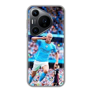 Чохли з футболістом Ерлінг Холанд для Huawei Pura 70 PRO (AlphaPrint) (фанати Холанда)