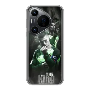 Чохол Кріштіану Роналду для Huawei Pura 70 PRO (AlphaPrint) (Крістіано Лев)